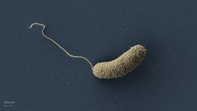 Elektronenmikroskopische Aufnahme eines Cholera-Erregers Vibrio cholerae (nachträglich koloriert). 