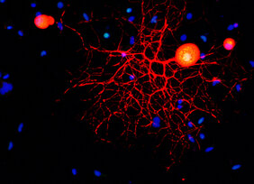 Konfokalmikroskopische Aufnahme eines peripheren sensorischen Neurons in Kultur.