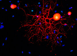 Konfokalmikroskopische Aufnahme eines peripheren sensorischen Neurons in Kultur.