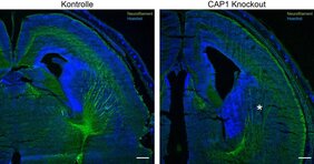Schaltet man das Protein CAP1 aus (Bild rechts), so bilden sich im Gehirn weniger Nervenfasern (grün gefärbt) als normalerweise