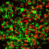 CD177-generierte betazellähnliche Zellen, die mit Antikörpern gegen Insulin (grün) und gegen den Betazell-Transkriptionsfaktor MAFA (rot) gefärbt wurden. 