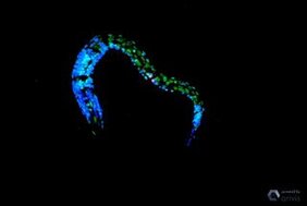 Das Bild zeigt eine konfokale Mikroskopie von C. elegans nach UV-Bestrahlung. Es treten vermehrt Doppelbesetzungen der Histone auf: H3K4me2 in grün.