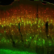 Im histologischen Hirnschnitt wurden Teile der extrazellulären Matrix (grün), die die Nervenzellen (rot) umgibt, angefärbt und unter dem Mikroskop analysiert.  