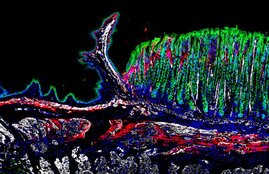 Gewebeschnitt aus dem gastroösophagealen Übergang einer Maus, der die räumliche Verteilung der verschiedenen Zelltypen durch Immunfärbung zeigt: Grün markiert Epithelzellen, rot und weiß zeigen verschiedene Fibroblasten-Subpopulationen. 