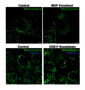 Mitochondrien MOF COX17