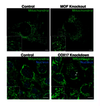 Mitochondrien MOF COX17