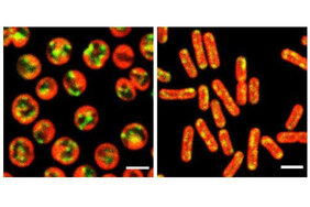 Darstellung mit einem konfokalen Mikroskop von zwei verschiedenen Cyanobakterienstämmen: Autofluoreszenz der Pigmente der Thylakoidmembran (rot), die Signale von mRNAs (grün) sowie die Kolokalisation beider Signale (gelb).