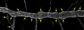 Lichtmikroskopische Aufnahme des Atemorgans eines Drosophila Embryos. Die gelben Pfeile zeigen auf ungewöhnliche Ausbeulungen eines eigentlich glatten röhrenförmigen Tracheenastes.