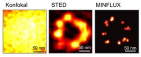 MINFLUX-Nanoskopie sieht Zellen molekular scharf
