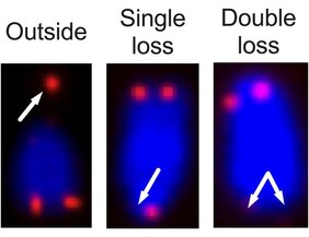 Telomere in Zellen ohne SAMHD1 zeigen eine Form des DNA Schadens