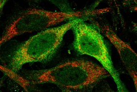 Das Enzym STARD7 hilft den Mitochondrien