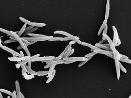 Elektronenmikroskopieaufnahme von Fusobakterien 