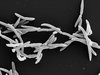 Elektronenmikroskopieaufnahme von Fusobakterien 