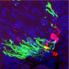 In vivo-Myelinisierung nach Transplantation von vordifferenzierten Prä-Oligodendrozyten 