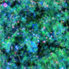 MiROM-Mikroskopaufnahme von lebenden Adipozyten (1mm x 1mm): Lipide (rot), Proteine (grün) und Kohlenhydrate (blau).