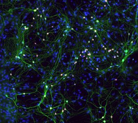 Nervenzellen (grün) bilden neuronale Netzwerke, in denen Informationen übertragen werden. 