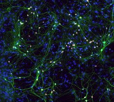 Nervenzellen (grün) bilden neuronale Netzwerke, in denen Informationen übertragen werden. 