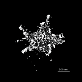  Endogener ASC-Speck, abgebildet in 3D mit dSTORM 