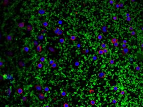 Mikroskopaufnahme: Blutplättchen (grün) tragen zur Aktivierung von Inflammasomen in weißen Blutzellen (rot; Zellkerne: blau) bei und somit zu einer vermehrten IL-1-Produktion.
