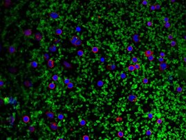 Mikroskopaufnahme: Blutplättchen (grün) tragen zur Aktivierung von Inflammasomen in weißen Blutzellen (rot; Zellkerne: blau) bei und somit zu einer vermehrten IL-1-Produktion.