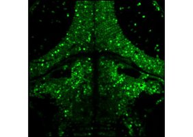 Ein Bild des Gehirns einer Zebrafisch-Larve. Jeder Punkt ist ein einzelnes Neuron. 