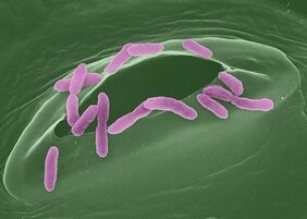 Rasterelektronenmikroskopaufnahme von Pseudomonas-Bakterien