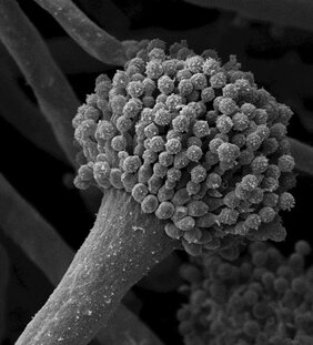 Rasterelektronenmikroskopische Aufnahme eines Sporenträgers von A. fumigatus