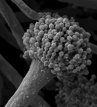 Rasterelektronenmikroskopische Aufnahme eines Sporenträgers von A. fumigatus