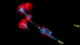 Durch die Bildung von langen fadenähnlichen Zellen, den Hyphen, bricht der Hefepilz Candida albicans (blau) aus menschlichen Immunzellen (rot) aus. Durch die Bildung von langen fadenähnlichen Zellen, den Hyphen, bricht der Hefepilz Candida albicans (blau) aus menschlichen Immunzellen (rot) aus.