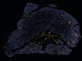 Schnitt durch eine Bauchspeicheldrüse: Jede Farbe repräsentiert einen anderen Zelltyp
