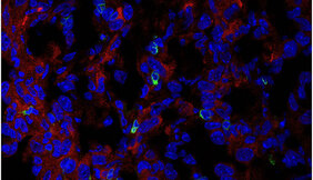  Immunfluoreszenzbild der Expression von PHGDH (rot) und CD3-T-Zellen (grün) im kryogeschnittenen AE17-Mesotheliom.