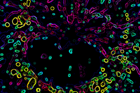 In diesem Bild identifizierte OrgaPlexing eine vierteilige Multiorganelleneinheit in einem entzündlichen Maus-Makrophagen.