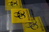 Drei gelbe "Biohazard"-Schilder