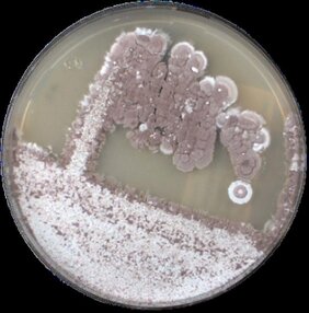 Agarplatte mit Antibiotika-Produzent Streptomyces lonegramiae 