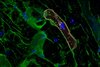 Hypertrophe Kardiomyopathie. Das Gen PRR16 (gelb) in einem Kardiomyozyt (orange) ist überaktiv. Die mikroskopische Aufnahme zeigt einen Schnitt durch das Herzgewebe eines an hypertropher Kardiomyopathie (HCM) erkrankten Menschen.