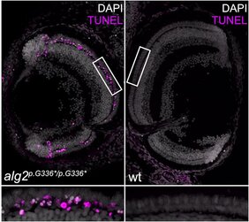 Die Netzhaut der Medakafische mit Mutation im ALG2-Gen