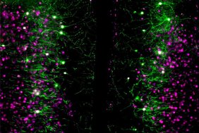 Dieses Mikroskop-Bild zeigt einen Blick in den medialen präfrontalen Kortex des Gehirns