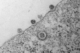 Die elektronenmikroskopische Aufnahme zeigt die Anfangsstadien des Sars-Cov-2-Infektionsprozesses bei einer 40.000-fachen Vergrößerung. Es sind vier Coronaviren zu sehen, die mit ihren verlängerten Spike-Proteinen an Einbuchtungen in der Zellmembran haften.