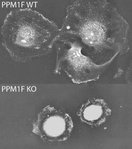  Im Gegensatz zu den wildtypischen Zellen (PPM1F WT) können sich Zellen ohne PPM1F (PPM1F KO) auf dem Substrat nicht richtig ausbreiten und bewegen sich nur eingeschränkt fort.