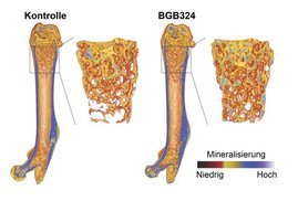 Die Mikro-Computertomographie zeigt, dass der mit dem Wirkstoff BGB324 behandelte Knochen eine höhere Dichte aufweist.