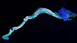 Der erwachsene Mitteldarm der Drosophila-Fliege Der erwachsene Mitteldarm der Drosophila-Fliege