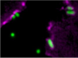 Pseudomonas aeruginosa Bakterien