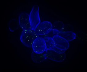Hefezellen (blau: Zellwand), beispielhaft ist ein Protein grün markiert.