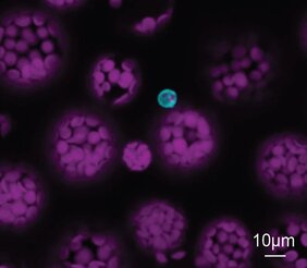 Isolierte Gefäßzellen von Arabidopsis