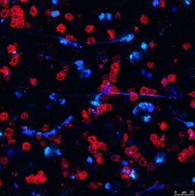 Darstellung von Neutrophilen (rot), die ein antimikrobielles Netz (blau) aus Proteinen und DNA, sog. Neutrophil Extracellular Traps, freisetzen