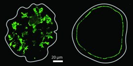 Mikroskopische Aufnahme mit einem sternförmigen Lumen auf der linken Seite und einem kugelförmigen Lumen auf der rechten Seite. Mikroskopische Aufnahme mit einem sternförmigen Lumen auf der linken Seite und einem kugelförmigen Lumen auf der rechten Seite.