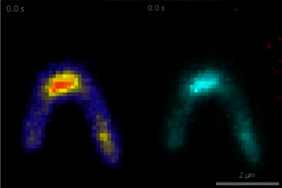 DNA Schlaufen