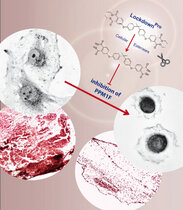 Mit seiner selektiven Hemmung der Proteinphosphatase PPM1F stoppt Lockdown die Tumorzellinvasion