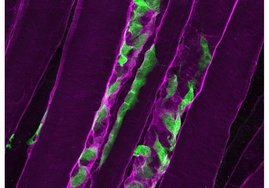 Nach einer Muskelverletzung sondern Muskelstammzellen (grün) Laminin- α2 (violett) in ihre Umgebung ab und regen so ihre eigene Teilung an. 