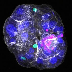 Periportales Assembloid, bei dem die drei Zelltypen sichtbar sind: Cholangiozyten in Rosa, Portalfibroblasten in Grün und Hepatozytenkerne in Blau; alle Zellgrenzen sind in Weiß dargestellt.